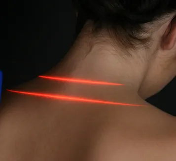 Cold Laser Therapy